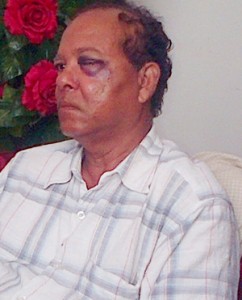 An injured Pastor Sewnauth Poonalall