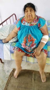 Ramkallie Rampat yesterday displaying her injuries