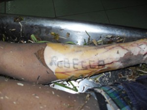 The victim’s tattooed arm 