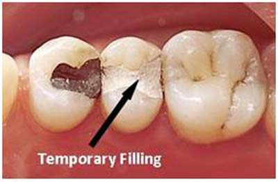 DENTAL HEALTHTEMPORARY FILLINGS - Kaieteur News