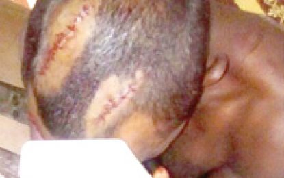 Convicted child-rapist Alvin Rudder beaten by fellow inmates