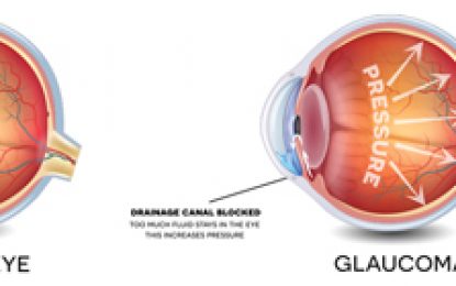 Free glaucoma screening being offered at GPHC