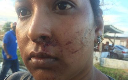 Stray catchers allegedly beat women, youth in clash over wandering cow