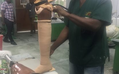 Over 200 benefit from Prosthesis workshop