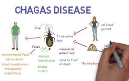 New guide introduced to improve diagnosis, treatment of Chagas Disease