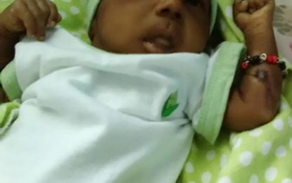 Post mortem inconclusive on baby burnt in GPHC incubator