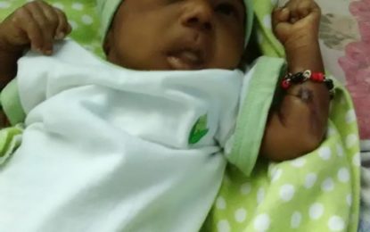 Baby burnt in incubator had health issues from premature birth
