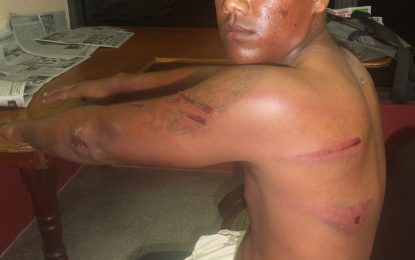 Resident alleges beating, harassment by businessman  -accuses police of collusion in corrupting justice
