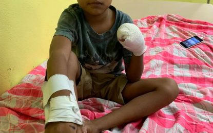 Boy, 5, loses four fingers after lighting squib