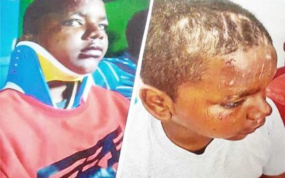 Months later, Bartica police still await DPP’s file to charge driver involved in accident with boy, 12