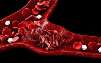 Non-cancerous blood disorders