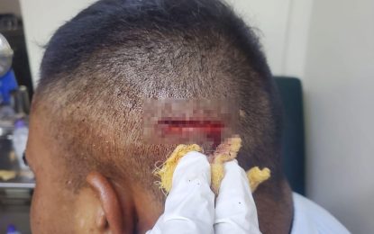 Cop receives 10 stitches to head for parting school boys’ fight