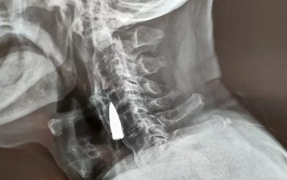 Child found with bullet lodged in throat