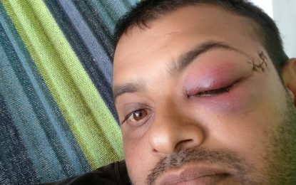 Man beaten for ‘picking-up fire rage’ for sister  