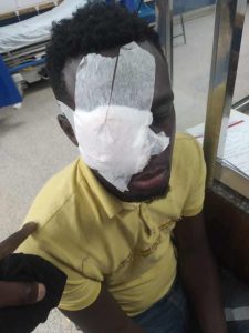 Linden man shot in eye by police