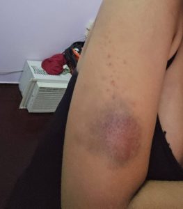 Woman details six-year abuse by husband