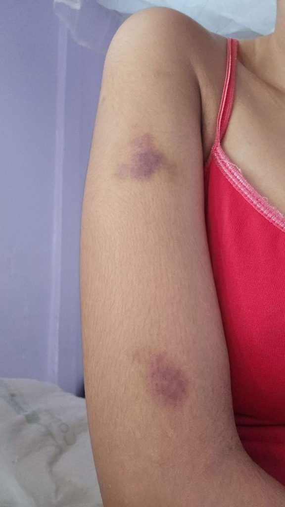Woman details six-year abuse by husband