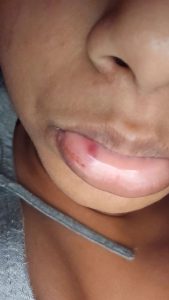 Woman details six-year abuse by husband
