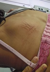 Woman details six-year abuse by husband